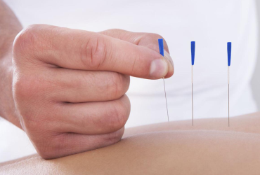 Zapraszamy na kurs SUCHE IGŁOWANIE (Dry needling) w ujęciu klinicznym w 2 modułach
